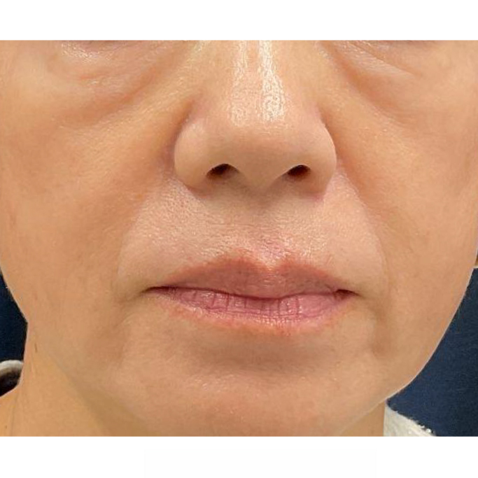 CASE03 1ヶ月半後